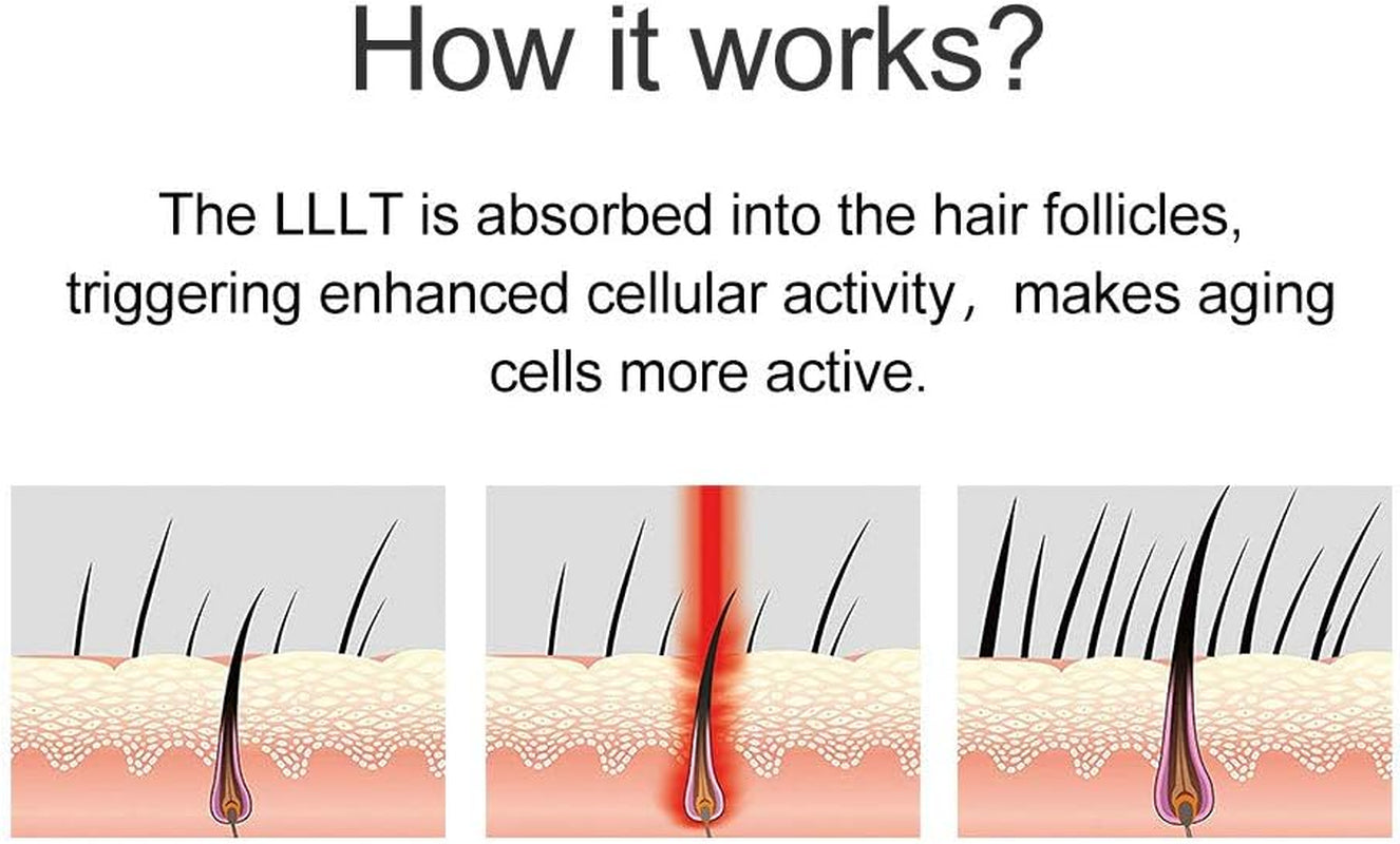 Tratamientos Crecepelos, Crecimiento Del Cabello - Aprobado Por La FDA, Restaura El Volumen Y La Densidad Del Grosor Del Cabello - Apropiado Para Hombres Y Mujeres